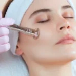 facial cupping