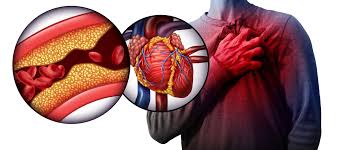 Heart disease chronic disease